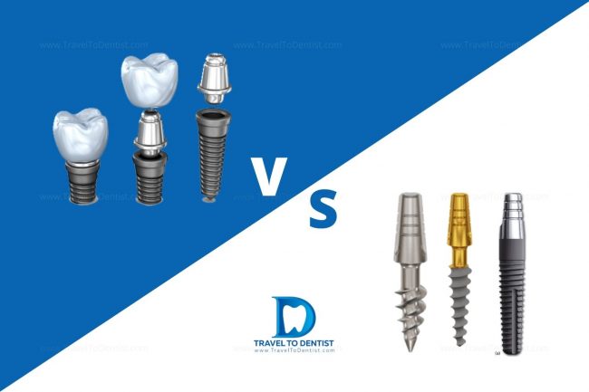 differenza tra impianti tradizionali e monoblocco