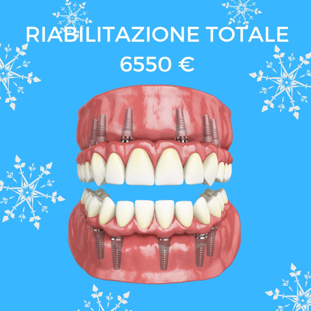 prezzo impianti dentali tutta la boca. 6550 euro: 12 impianti + 24 corone