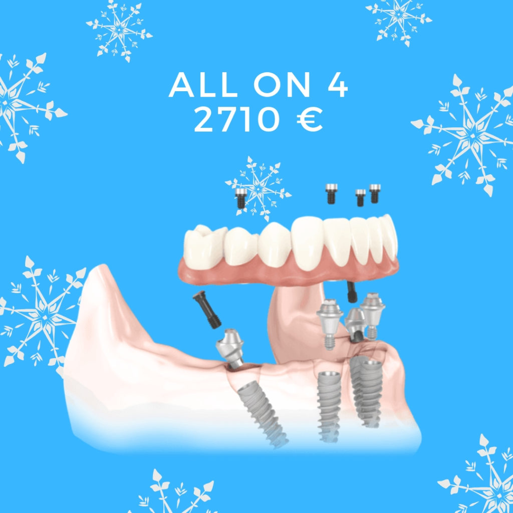 prezzo implantologia dentale in chisinau. All on 4 = 4 impainti + 10 denti in metalloceramica 2710 euro