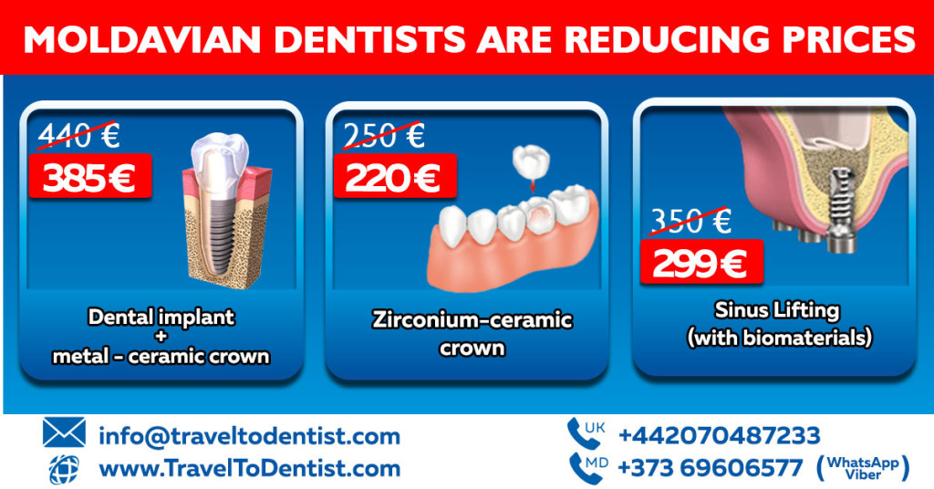 Moldavian dentists are reducing prices. Why, since when and how can you
