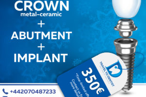incredible prices for dental implants in Moldavia: 350 € including implant, abutment and metal-ceramic crown