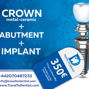 incredible prices for dental implants in Moldavia: 350 € including implant, abutment and metal-ceramic crown