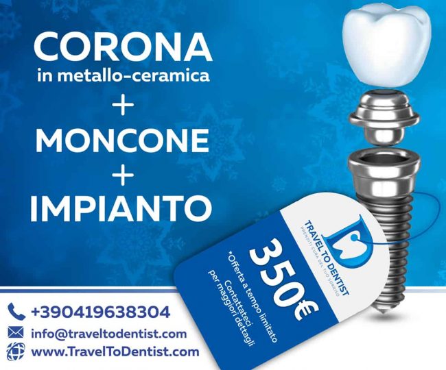 prezzi incredibili per impianti dentali in moldavia: 350 euro compreso impianto, moncone e corona metallo-ceramica