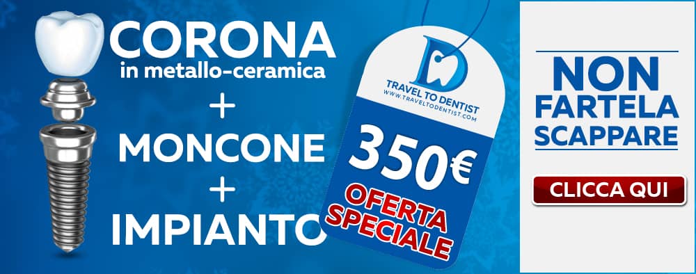 Offerta speciale per impianti dentali in Moldavia: impianto + moncone + corona = 350 euro