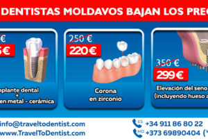 Las mejores dentistas en Moldavia bajaron los precios de los tratamientos dentales
