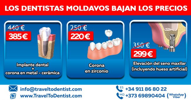 Las mejores dentistas en Moldavia bajaron los precios de los tratamientos dentales