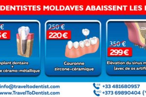 Les meilleurs dentistes en Moldavie abaissé les prix sur les traitements dentaires