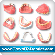 Plusieurs types de protheses dentaires