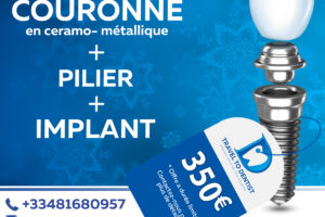 des prix incroyables pour les implants dentaires en Moldavie: 350 € compris l'implant, pilier et couronne céramo-métallique