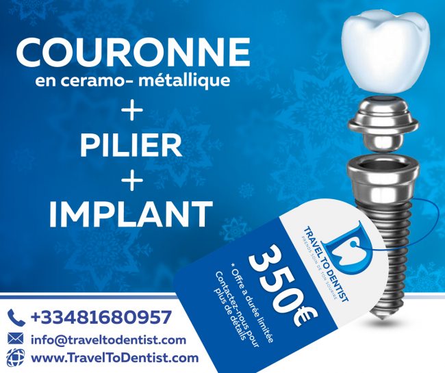 des prix incroyables pour les implants dentaires en Moldavie: 350 € compris l'implant, pilier et couronne céramo-métallique