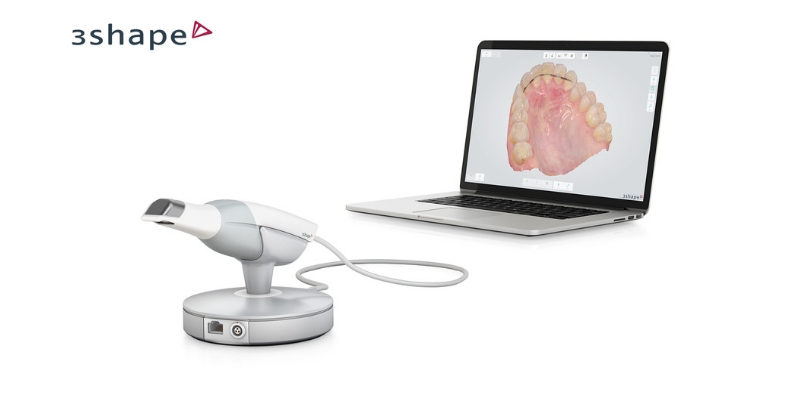 intraoral scanner - for digital 3D impressions