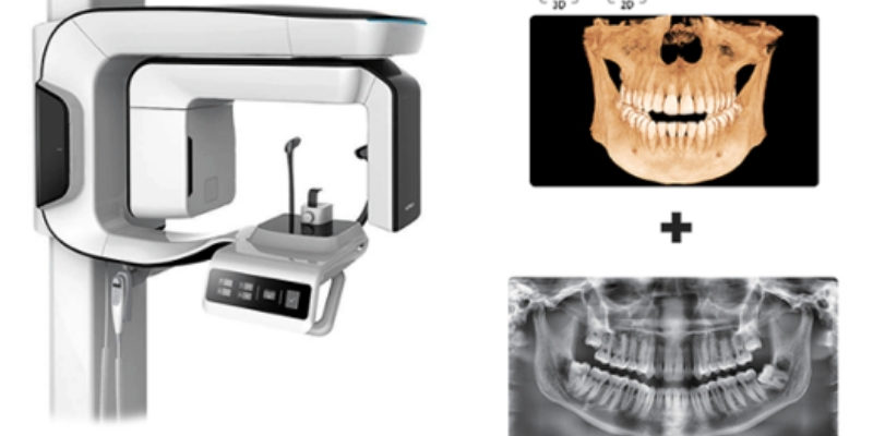 3D Dental computed tomography in Chisinau - 