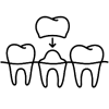 crown on tooth