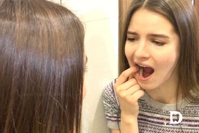 Überprüfen Sie Ihre Zähne häufiger und stellen Sie rechtzeitig fest, ob Sie bewegliche Zähne haben