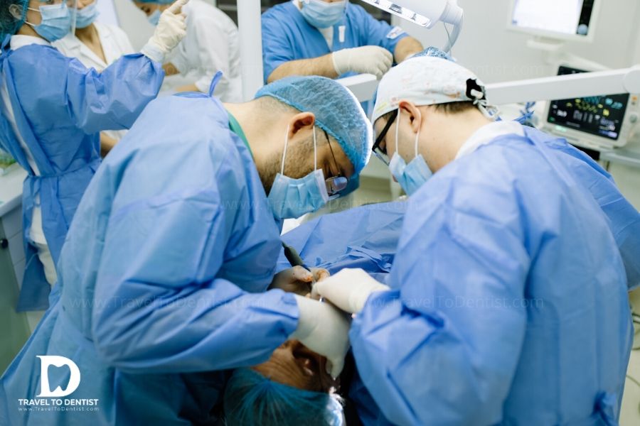хирургическая установка скуловых имплантов в кишиневе