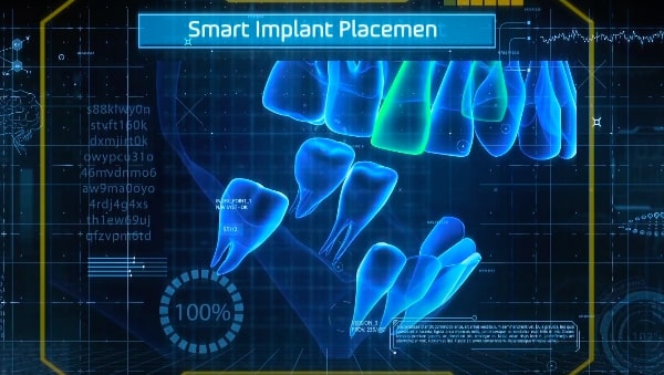 Vatech - Smart technologies in dentistry