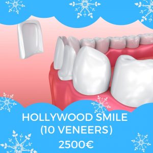 hollywood smile (10 Veneers) Price in dental clinic Chisinau 2500€